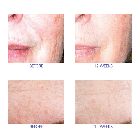 Active Serum - Сироватка для обличчя