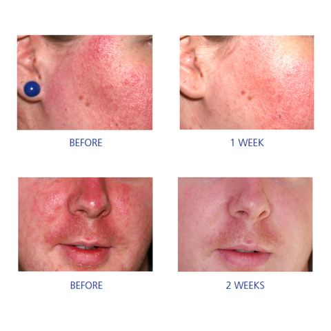 Pro-Heal Serum Advance+ - Сироватка Pro-Heal Едванс+
