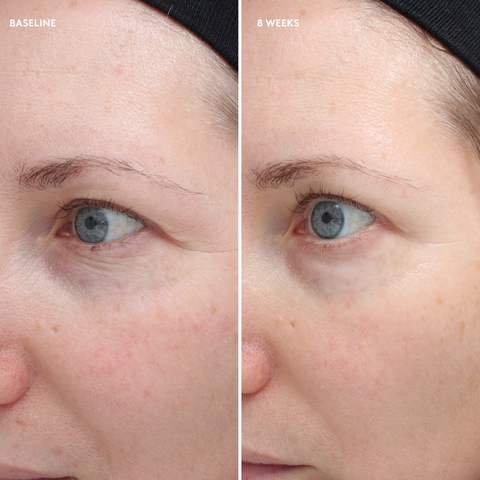 Firm and Repair Cream - Зміцнювальний і відновлювальний крем для повік (Total Eye®)